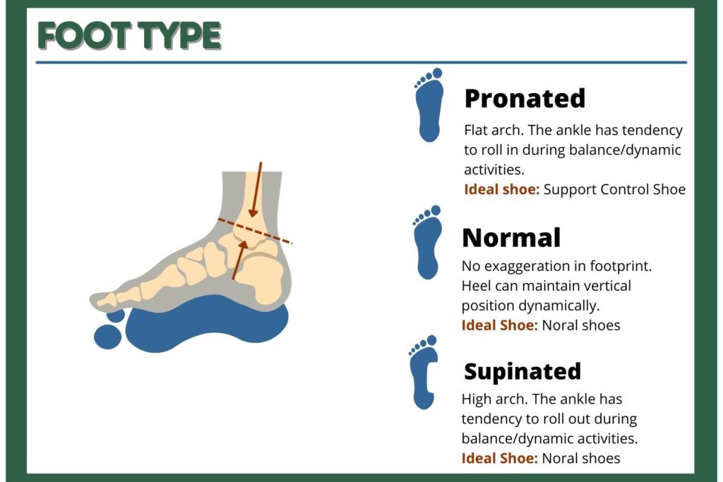 How Should Tennis Shoes Fit: Foot Type