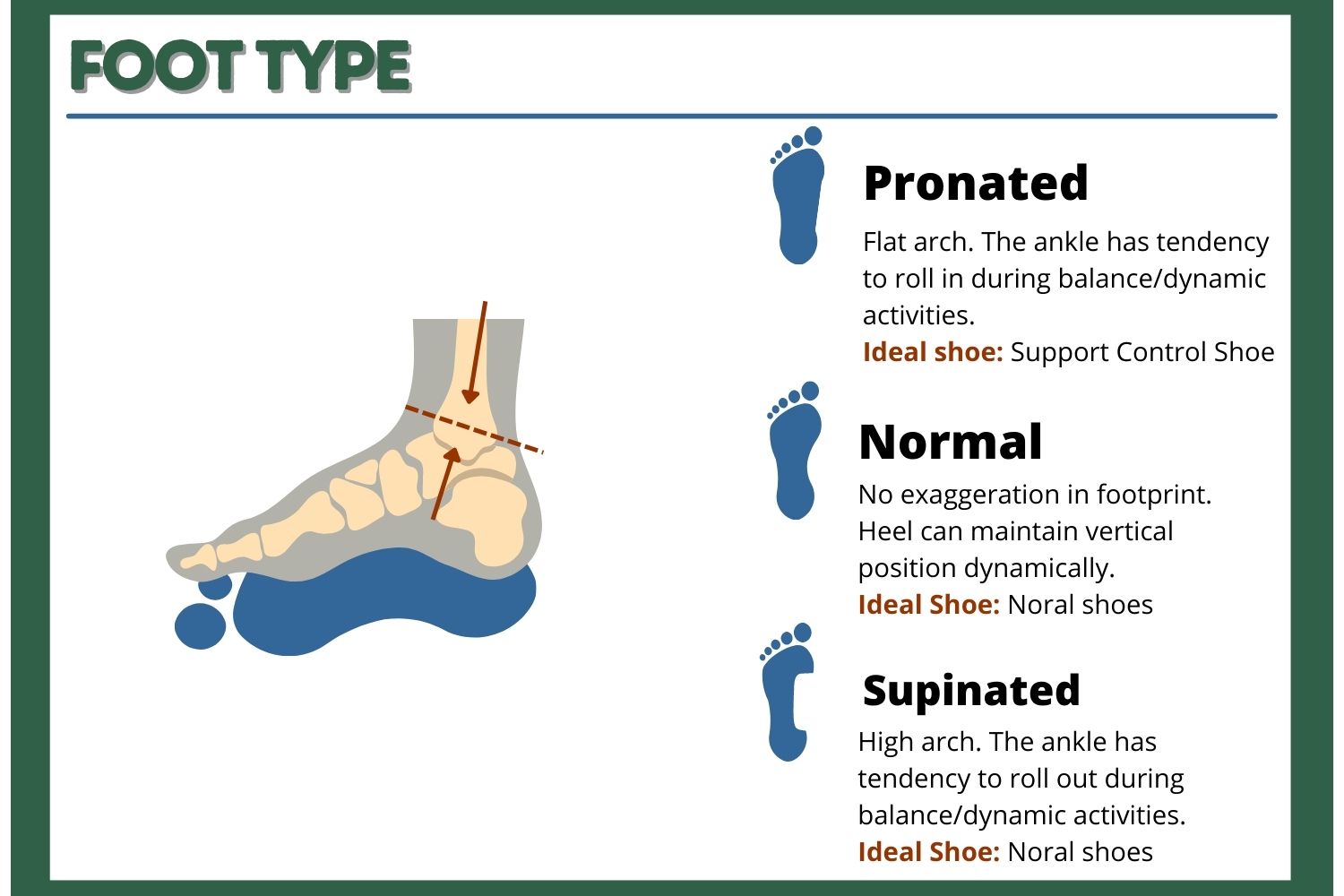 Solved! How Should Tennis Shoes Fit?